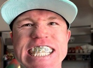 Rompió otro récord ante Berlanga: Canelo Álvarez y el protector bucal más caro de la historia